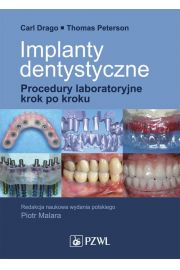 eBook Implanty dentystyczne. Procedury laboratoryjne krok po kroku mobi epub