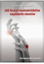 eBook Jak leczy reumatoidalne zapalenie staww. Poradnik dla chorych pdf mobi epub