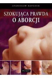 eBook Szokujca prawda o aborcji pdf