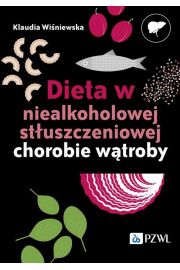 eBook Dieta w niealkoholowej stuszczeniowej chorobie wtroby mobi epub