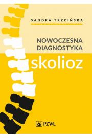 eBook Nowoczesna diagnostyka skolioz mobi epub