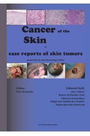 eBook Cancer of the Skin - case reports of skin tumors pdf epub