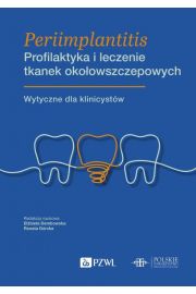 eBook Periimplantitis Profilaktyka i leczenie tkanek okoowszczepowych mobi epub