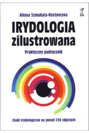 Irydologia zilustrowana