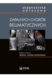 eBook Diagnostyka obrazowa zapalnych chorb reumatycznych mobi epub