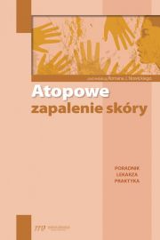 Atopowe zapalenie skóry. Poradnik lekarza praktyka