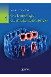 eBook Od bondingu do implantoprotetyki Cz 1 pdf mobi epub