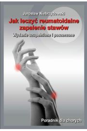 eBook Jak leczy reumatoidalne zapalenie staww II pdf mobi epub