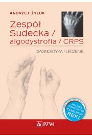 eBook Zesp Sudecka / Algodystrofia / CRPS mobi epub
