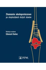 eBook Zamania okooprotezowe po aloplastykach duych staww mobi epub