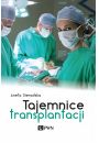 eBook Tajemnice transplantacji mobi epub