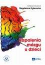 eBook Zapalenia mzgu u dzieci mobi