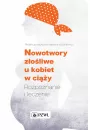 eBook Nowotwory zoliwe u kobiet w ciy mobi epub